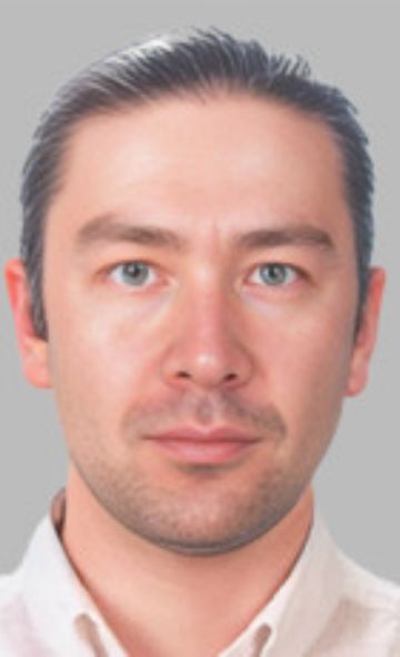 Facelift procedure